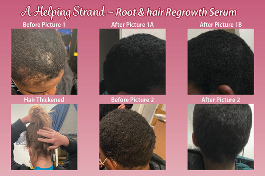 A Helping Strand Root & Hair Regrowth Serum